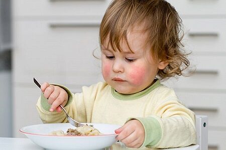 عکس, آلرژی غذایی در کودکان تا چه سنی است