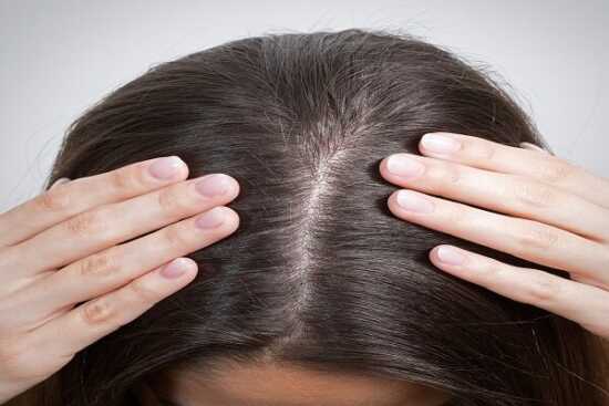 عکس, داروها و درمان سنتی افزایش تراکم جلوی مو در زنان و مردان