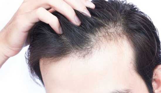 عکس, ویتامین ها و املاح مخصوص تقویت مو و دوز مصرفی آن ها