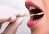 عکس سفت و زرد شدن آب بزاق دهان به چه علت است درمان ها