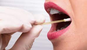 عکس, سفت و زرد شدن آب بزاق دهان به چه علت است درمان ها