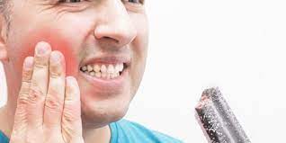 عکس, درمان های خانگی حساس شدن دندان ها
