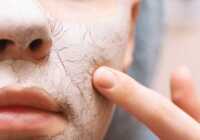عکس آموزش ماسک خاک رس برای انواع پوست