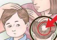 عکس درمان سنتی و قطعی ریزش موی پسرهای هفت تا پانزده سال