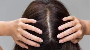 عکس, روش استفاده از کشک برای تقویت کردن موها