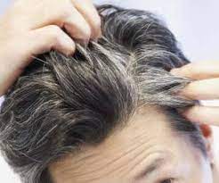 عکس, دو ویتامین موثر در درمان سفیدی موها