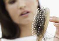 عکس درمان دارویی و خانگی ریزش موی پلی کیستیک در زنان